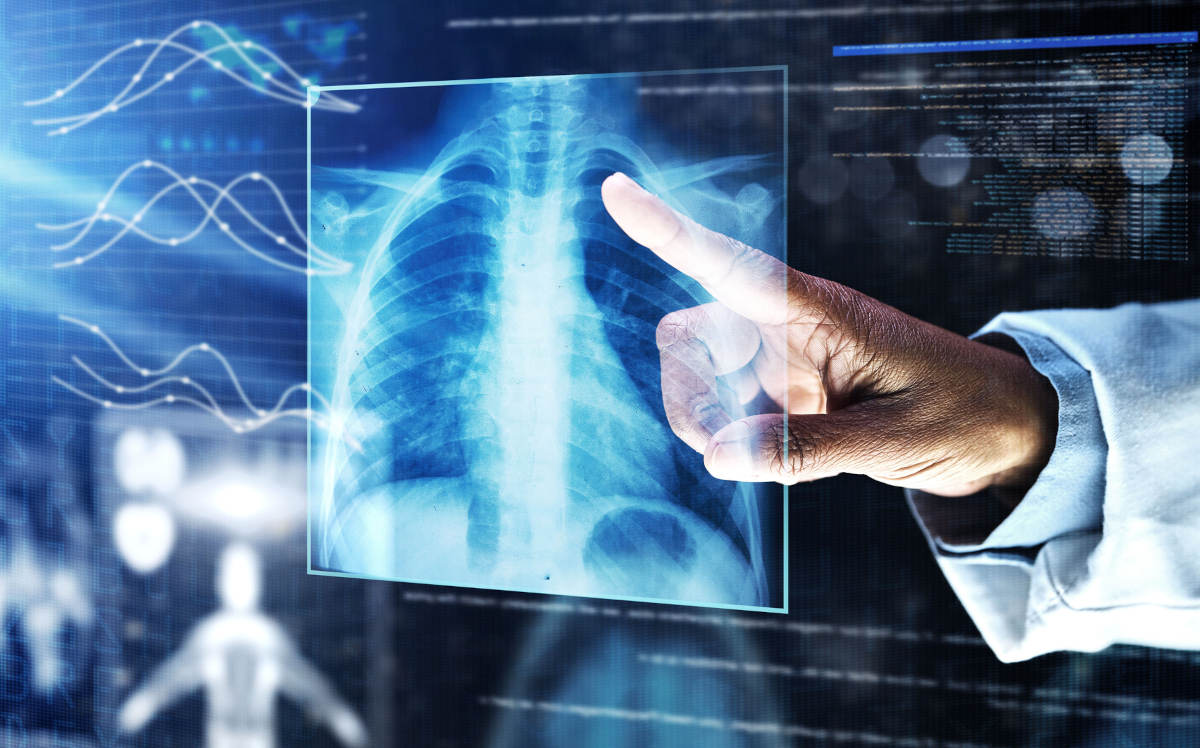 AI Implementation in Healthcare - How is the Medical Field Using Artificial Intelligence?